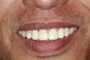 after image | bioclear | santa ana, ca