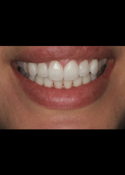Bioclear