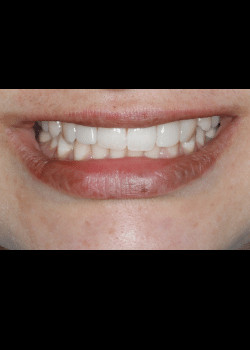 Bioclear