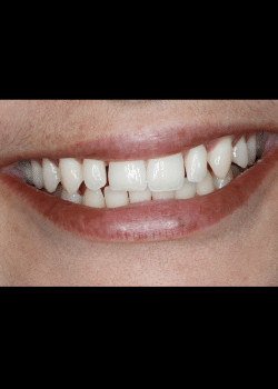 Bioclear